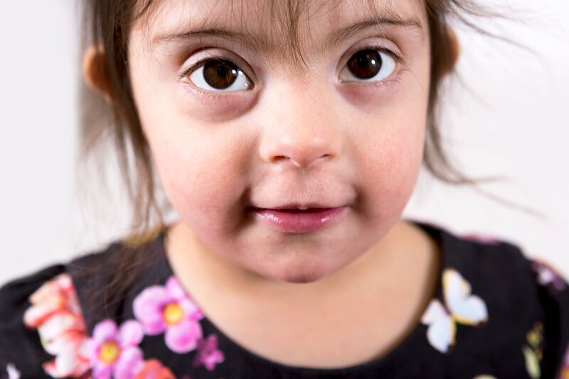 My baby has Down's syndrome support and information for new parents